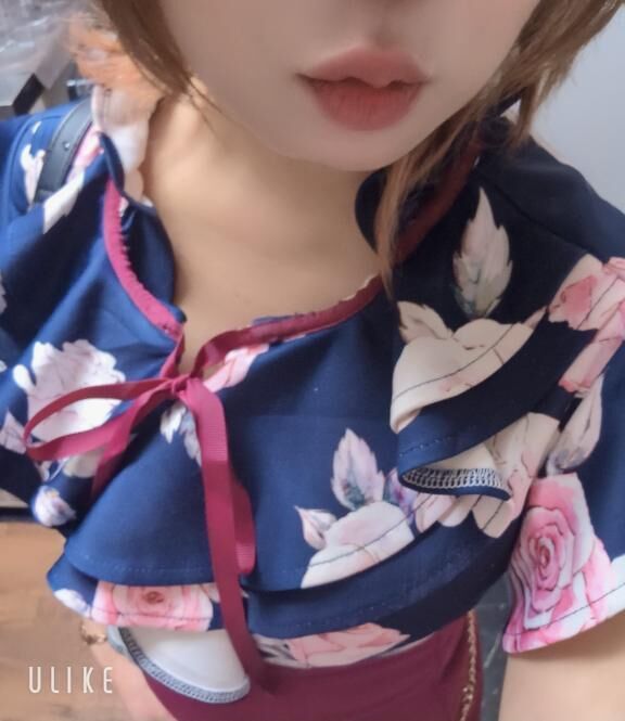 &#129401;&#129401;&#129401;&#9313;