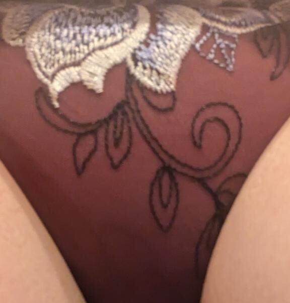 急遽