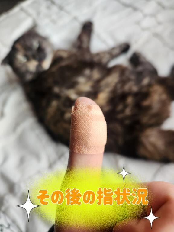指状況&#128077;