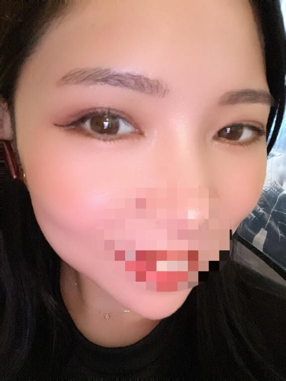 バリ痛かった&#9825;