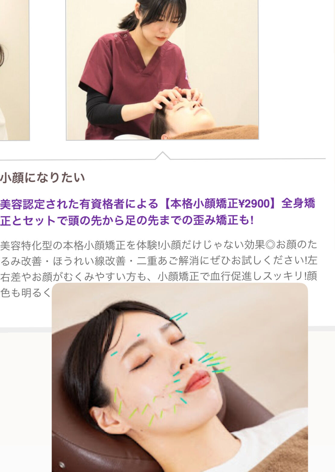 明日は全身整体と美容鍼へ&zwj;♀️