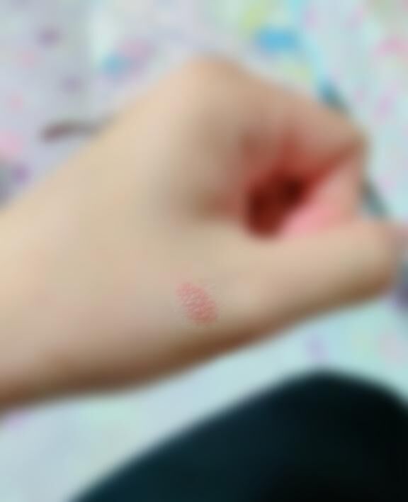 火傷&#128546;