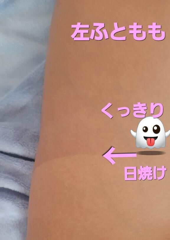 ！！日焼けに！気をつけよう！！お掃除していたら知らぬ間に！こんなに焼けたのだ&#x301C;( ；∀；)