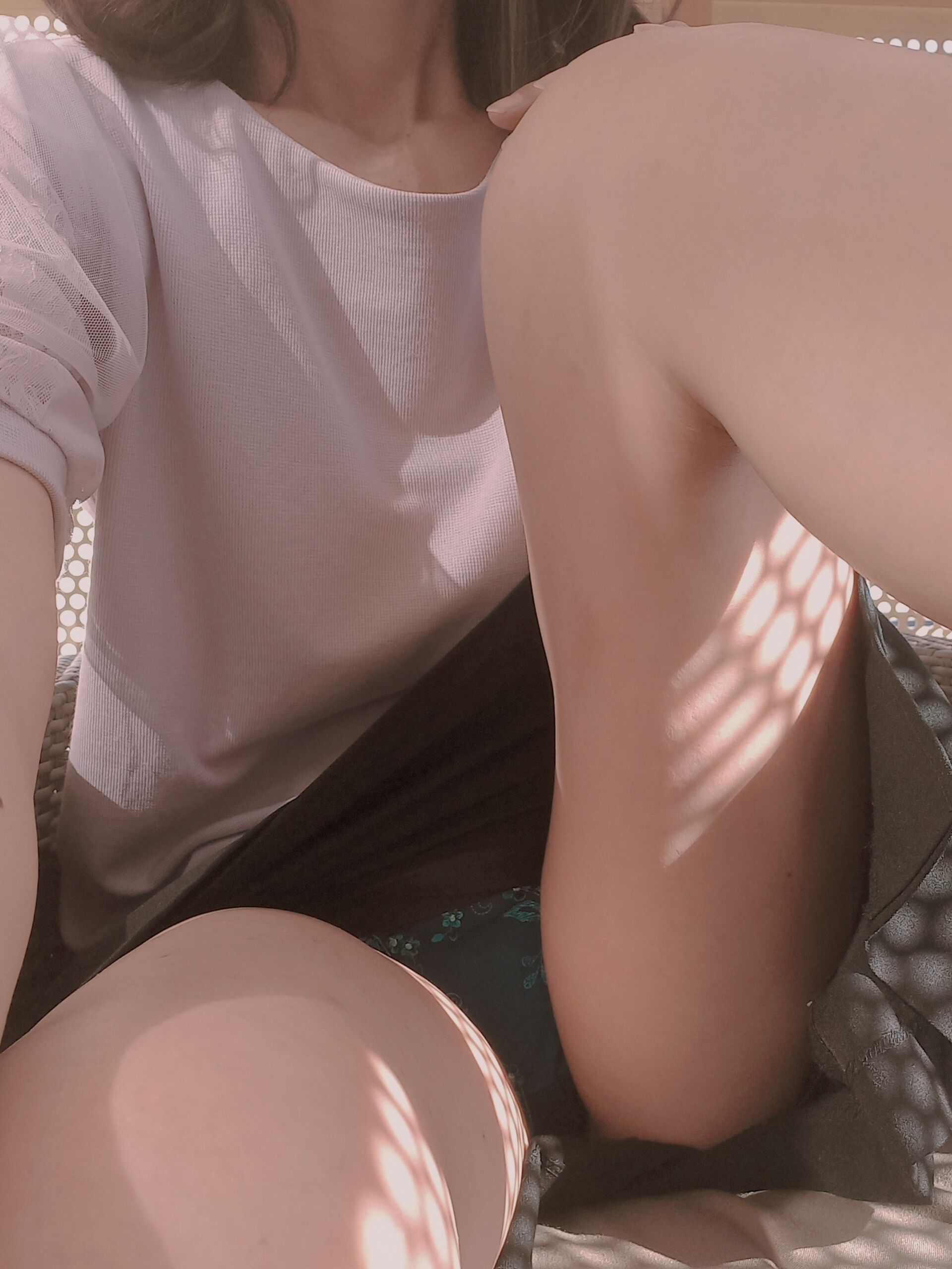 麻痺