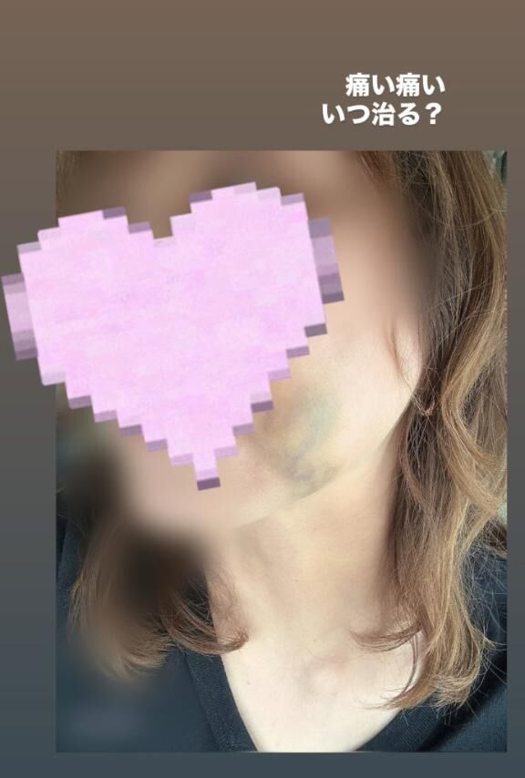 色々　障害　笑