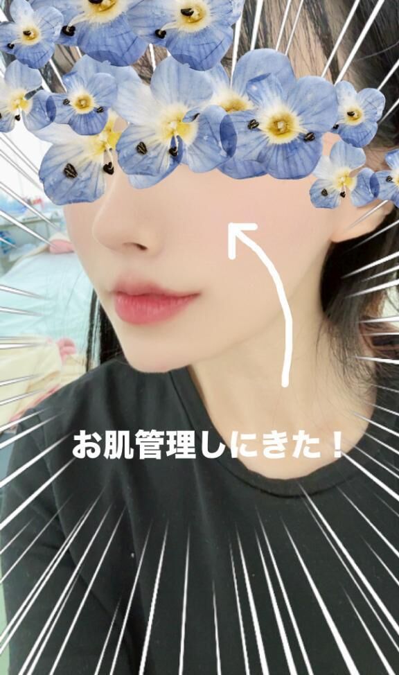 美容注射痛すぎました
