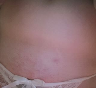 脱毛した結果は、、、&#9825;&#9825;