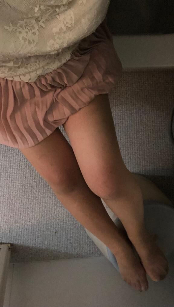 遅くにすみません。