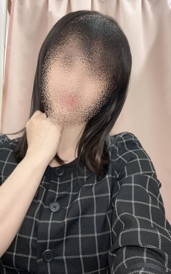 肩こりと腰痛のケア