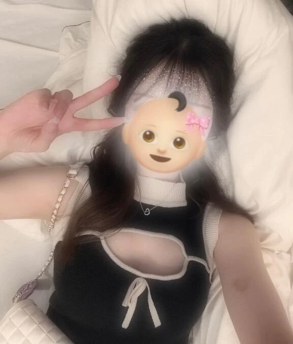 急激&#127539;