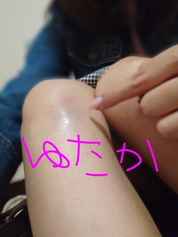 (♡ д・)ゞｲﾃﾃ…