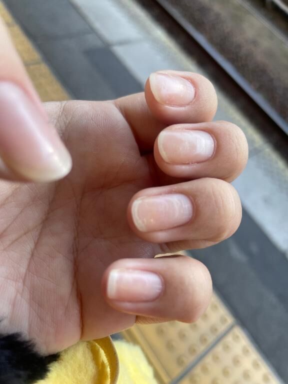 つめがあああああああ