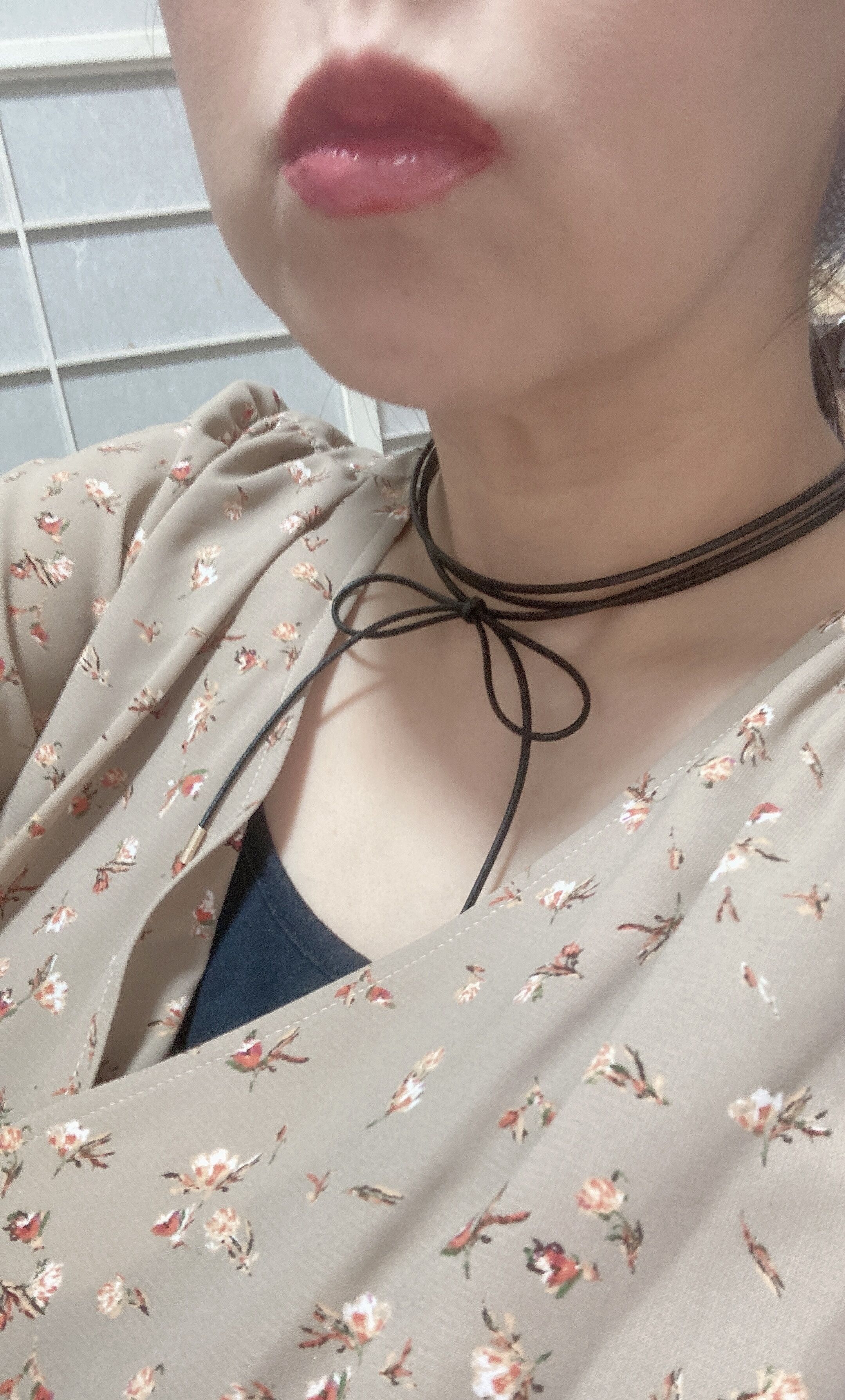 リハビリ行って来たよ