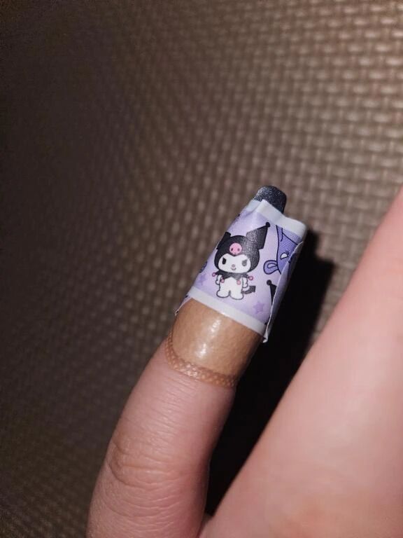 怪我したあああ&#129402;&#129402;&#129402;