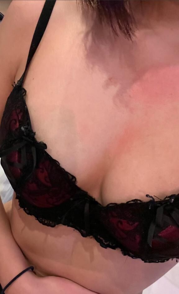 敏感肌なのかな♡