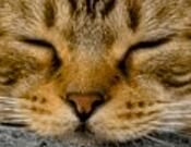 ヒアルロン酸注入ー✨