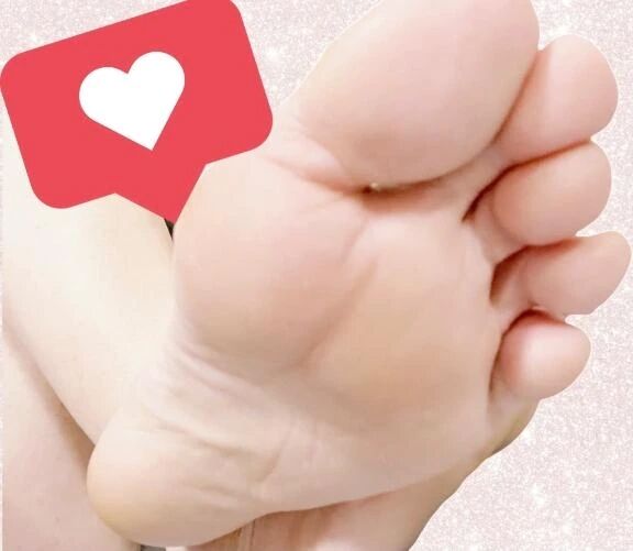 やっとふやけがとれました🦶❤︎ ͛⟡.&lrm;⋆