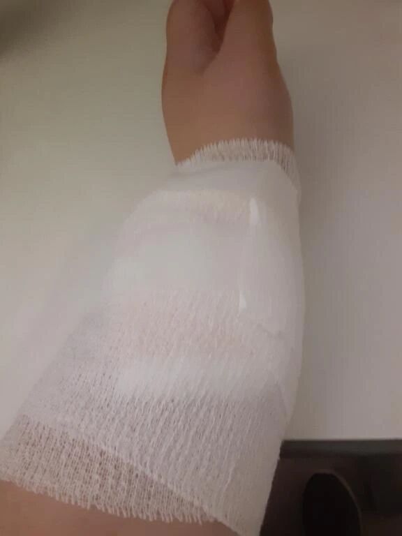 手術終わりました